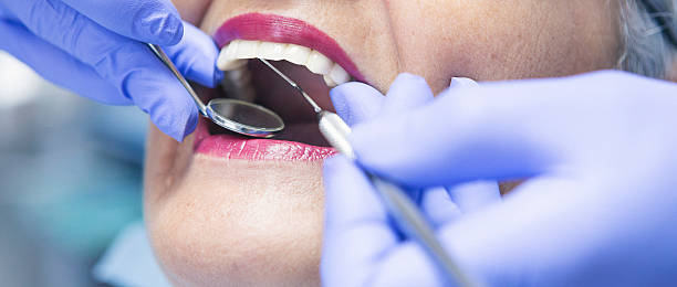 Best Emergency Dental Extractions in Fruitville, FL